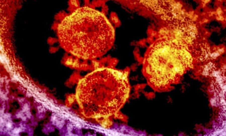 Coronavirus 2019 (COVID-19) : état de connaissance 17 mars 2020